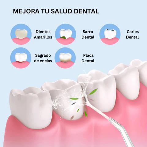 IRRIGADOR BUCAL